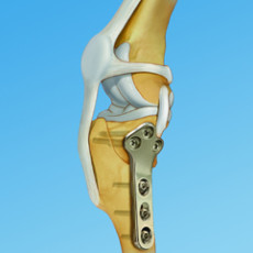 TPLO-230x230.jpg